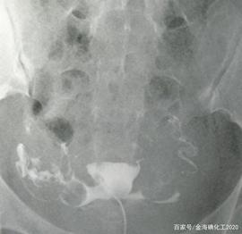 原料药在造影剂中所起的作用